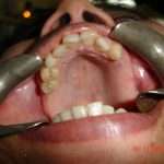 Prostho-Surg1-1-150x150