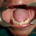 Prostho-Surg1-2-150x150