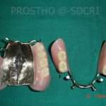 Prostho-Surg1-3-150x150