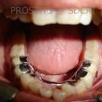 Prostho-Surg1-4-150x150
