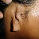 Prostho-Surg2-1-150x150
