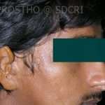 Prostho-Surg2-3-150x150
