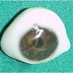 Prostho-eye-2-150x150