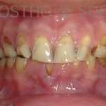 Prostho-surg3-1-150x150