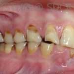 Prostho-surg3-2-150x150
