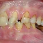 Prostho-surg3-3-150x150