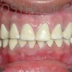 Prostho-surg3-4-150x150