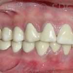 Prostho-surg3-5-150x150