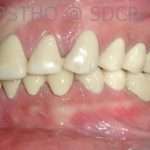 Prostho-surg3-6-150x150