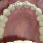 Prostho-surg3-7-150x150