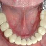 Prostho-surg3-8-150x150