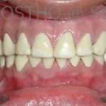 Prostho-surg3-9-150x150